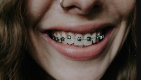 Noticeable Changes in Speech or Appearance