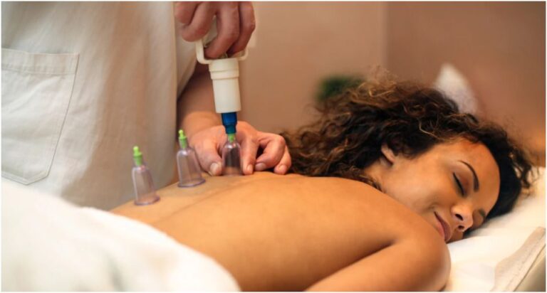 Wet Cupping Sydney: Exploring the Benefits of Ancient Healing Practices Wet Cupping Sydney: Exploring the Benefits of Ancient Healing Practices