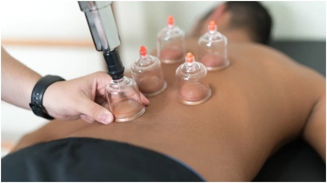 Wet Cupping for Holistic Wellbeing
