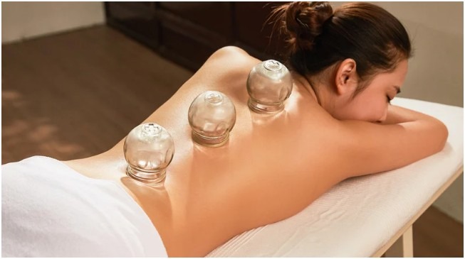 The Healing Potential of Wet Cupping