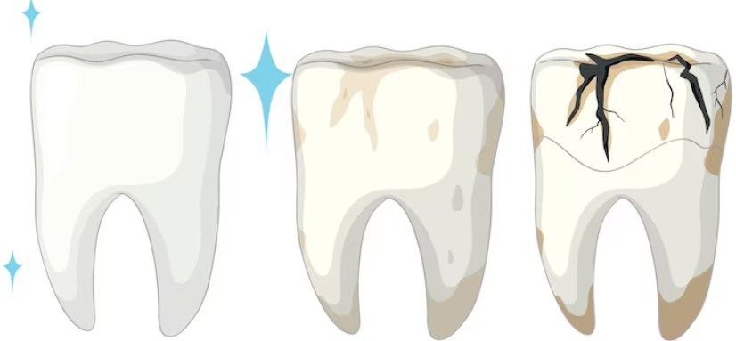 Clean Between the Spaces